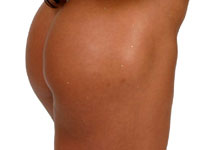 cuisse ferme avec le fitness